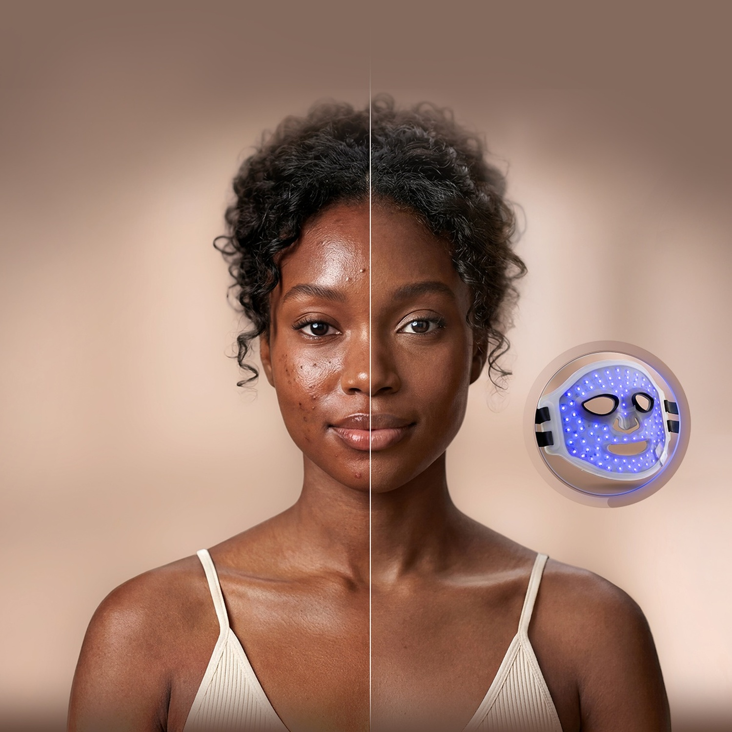 Confronto viso di una donna con acne a sinistra e pelle pulita a destra, con una maschera LED.