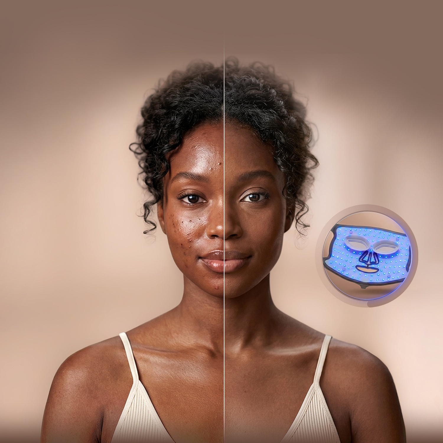 Donna di colore mostra un confronto prima e dopo usando una maschera a LED blu per l'acne.