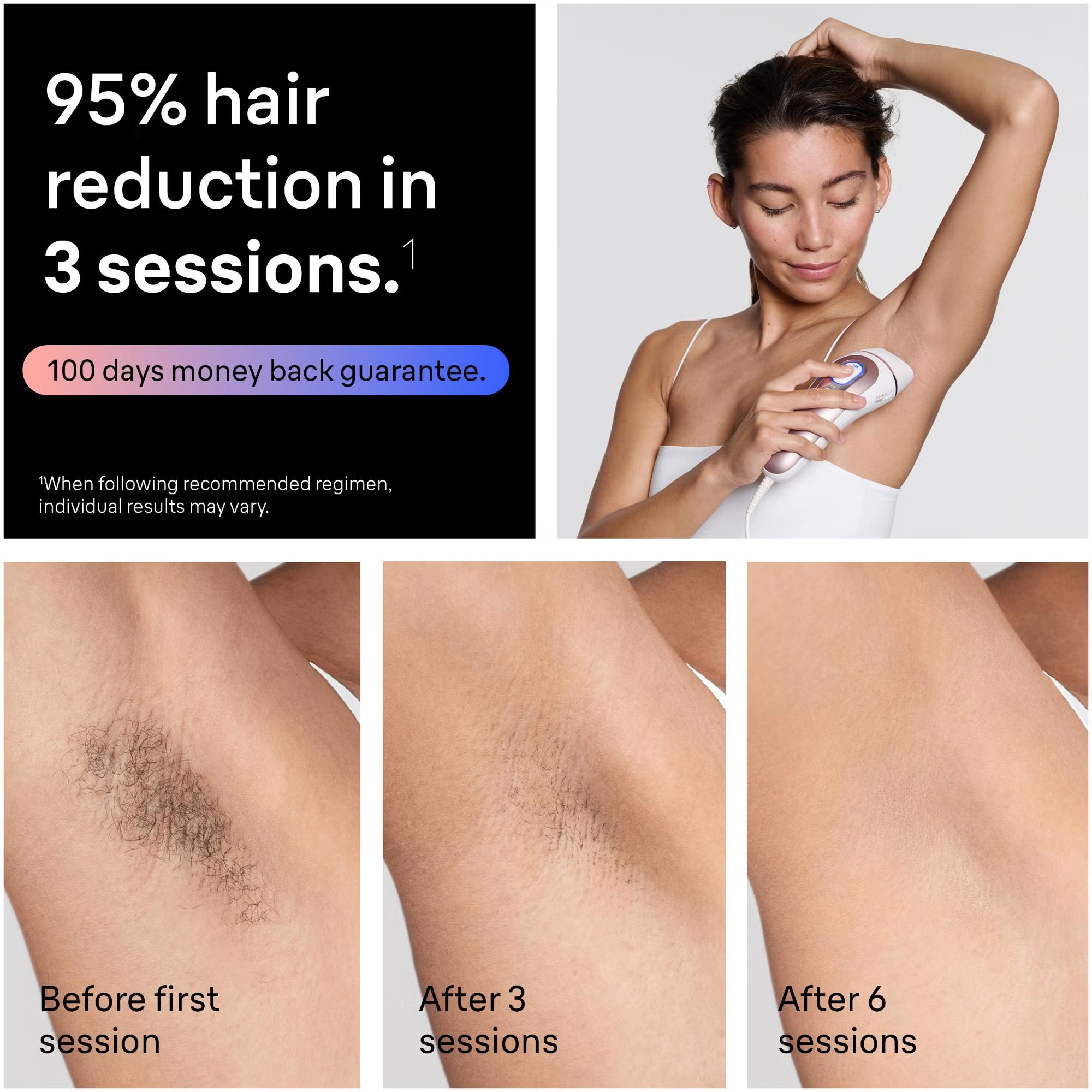 BRAUN Skin i·expert Pro 7 PL7321 Special IPL‑Haarentfernungsgerät, Weiss/Roségold