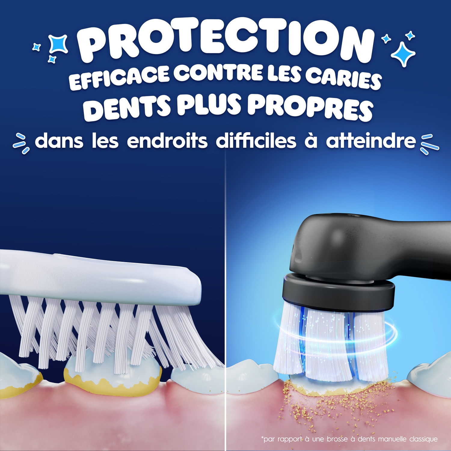 Comparaison montrant une brosse à dents manuelle avec plaque et une brosse électrique qui l'enlève.