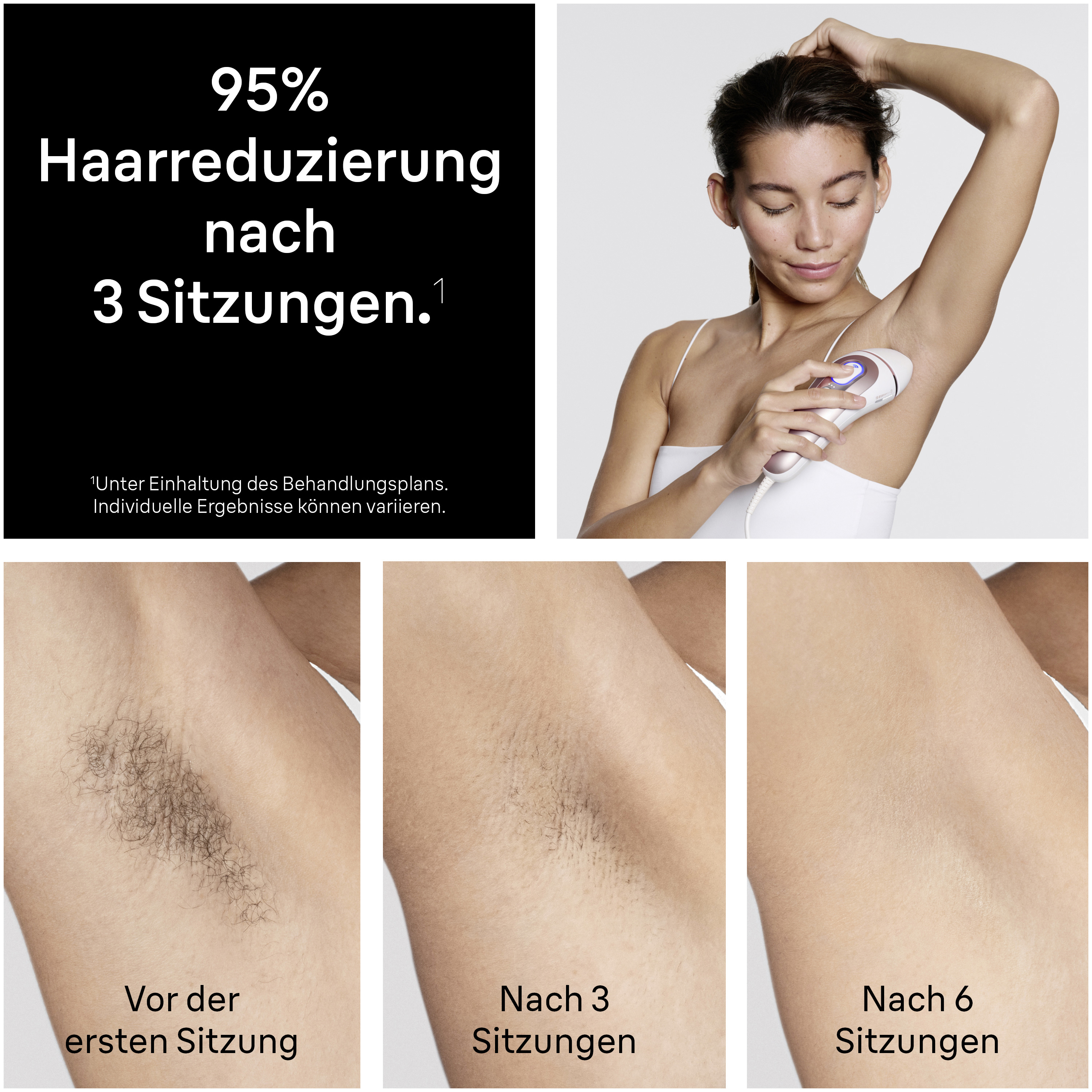 BRAUN Skin i-expert Pro IPL PL7321 - Golden Ribbon IPL-Lasergerät (Gold, mit Smart Flex Aufsatz, 2 Aufsätze, Tasche, Venus Rasierer, Netzbetrieb)