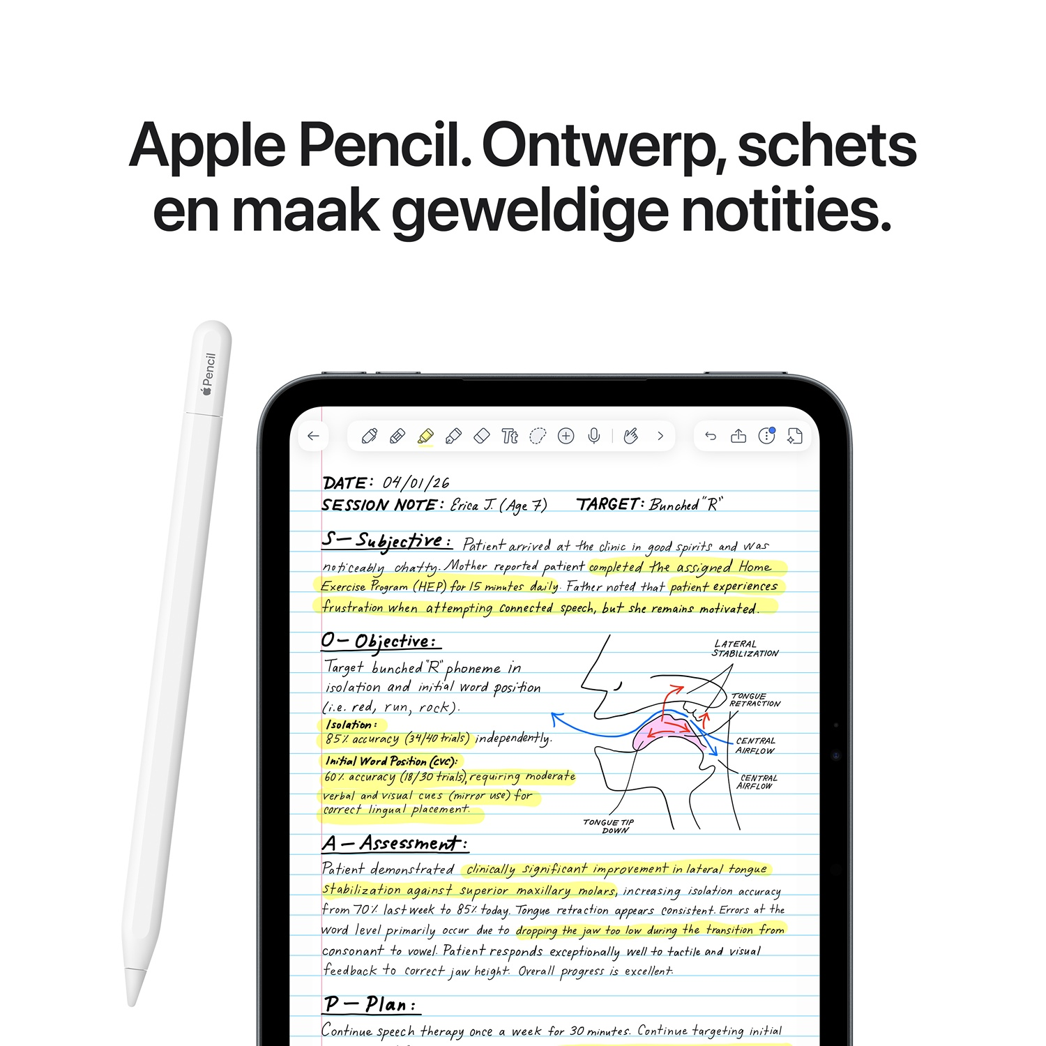 Apple Pencil en een tablet met handgeschreven medische notities en een diagram.