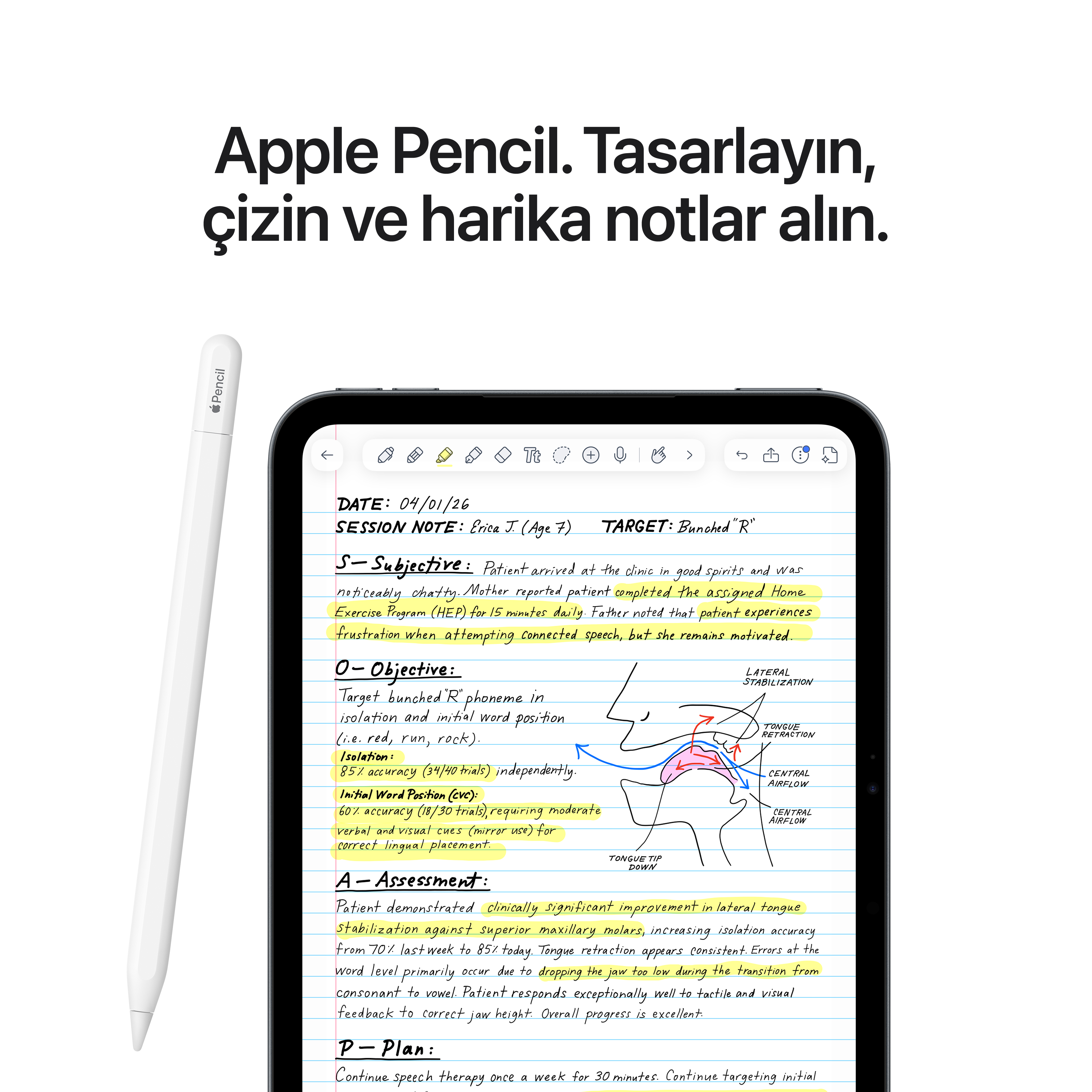 El yazısıyla yazılmış tıbbi notlar ve şemalar gösteren bir tabletin yanında Apple Pencil.