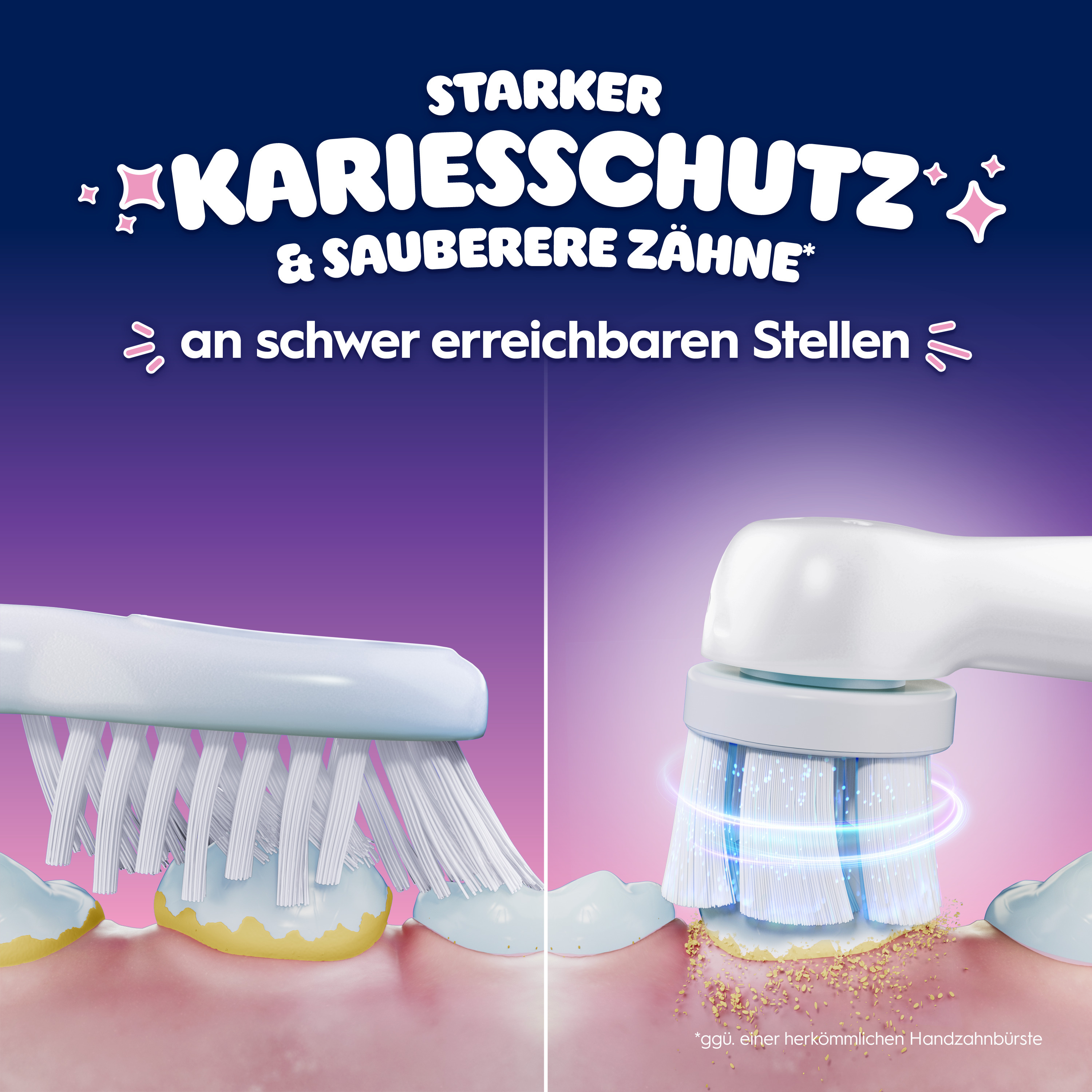 Vergleich von Handzahnbürste mit Plaque und elektrischer Zahnbürste, die Plaque effektiv entfernt.