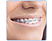 ORAL B Elektrische tandenborstel Smart Teen Black (4000)