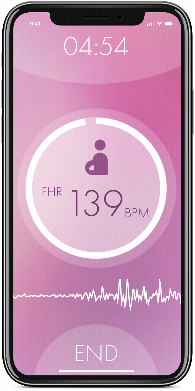 HERABEAT HERABEAT Fetal Doppler Weiß Fetal Doppler Weiß