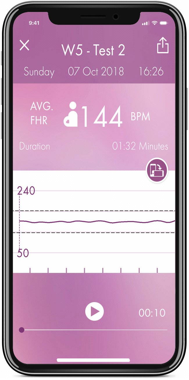 HERABEAT HERABEAT Fetal Doppler Weiß Fetal Doppler Weiß