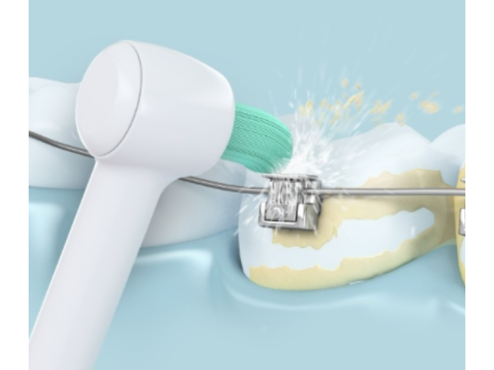 Un cepillo de dientes limpia dientes con aparatos ortopédicos. El agua sale a chorros del cepillo.
