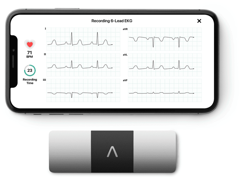 ALIVECOR KardiaMobile 6L hatelvezet ses EKG MediaMarkt online