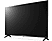 LG 43UP75009LF - TV (43 ", UHD 4K, LCD)