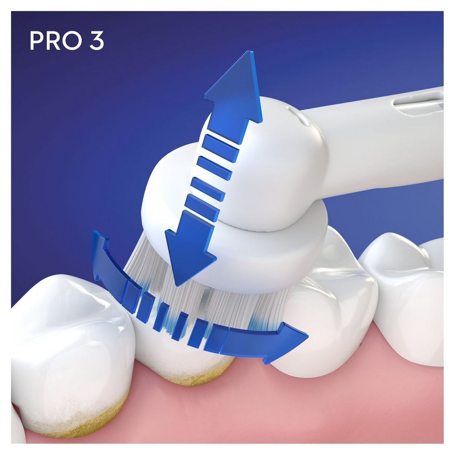Cepillo de dientes eléctrico limpiando dientes con flecha azul.