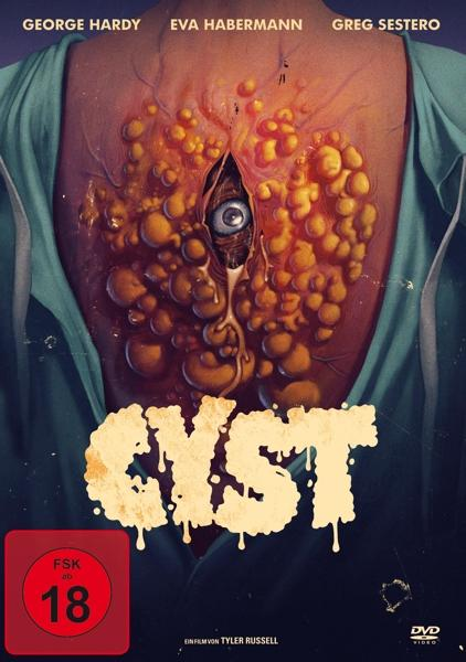 CYST DVD