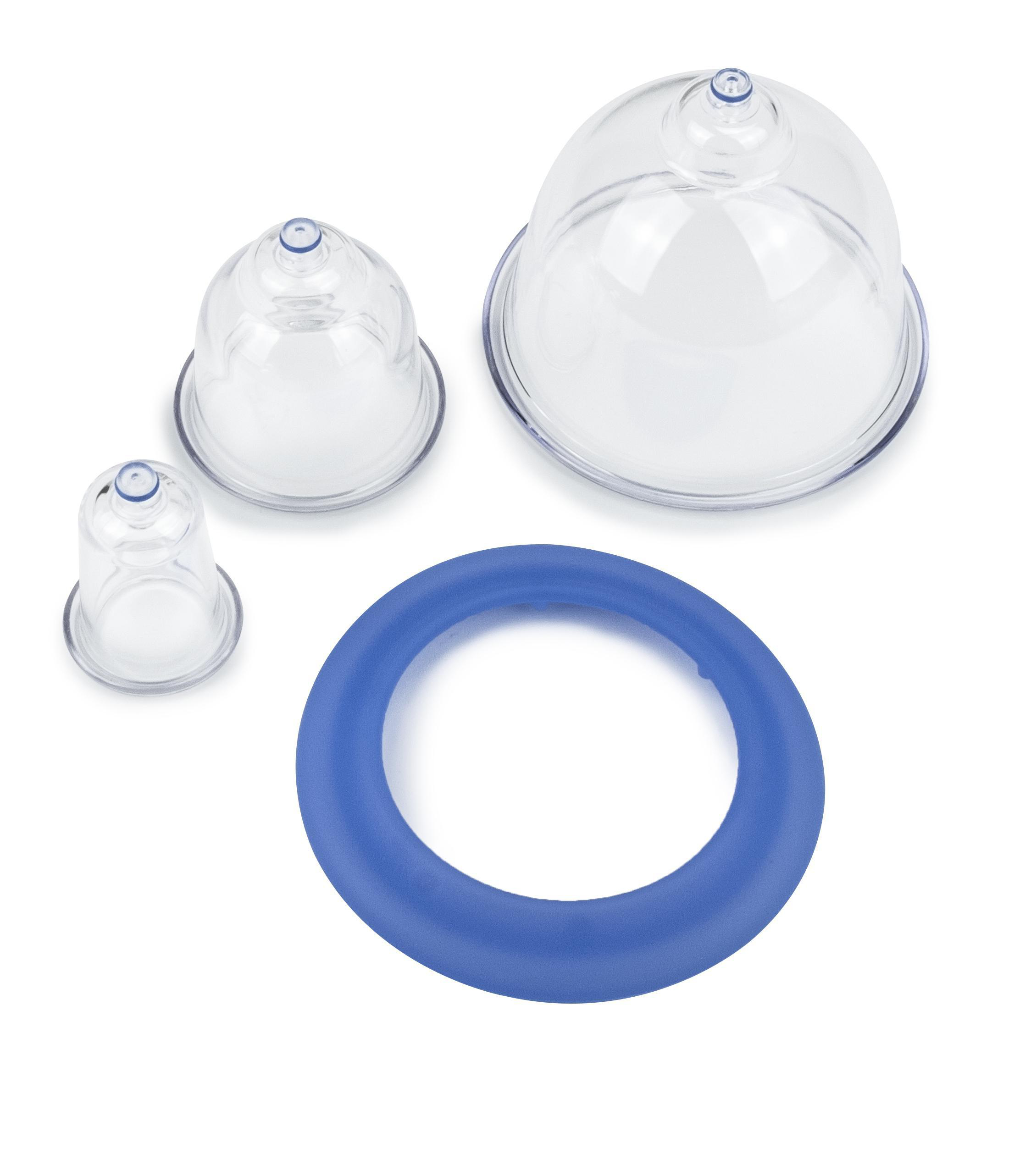 Drei durchsichtige Schröpfgläser und ein blauer Ring. Die Gläser sind unterschiedlich groß.