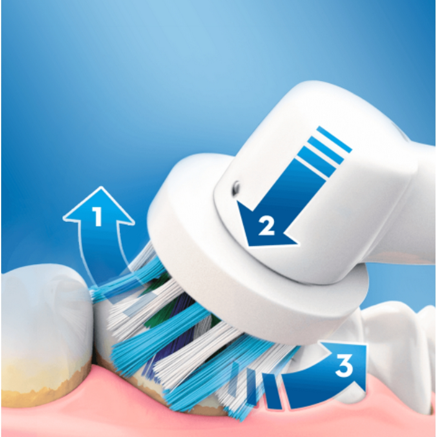 Primer plano de un cepillo de dientes eléctrico limpiando dientes, con flechas que muestran el proceso.