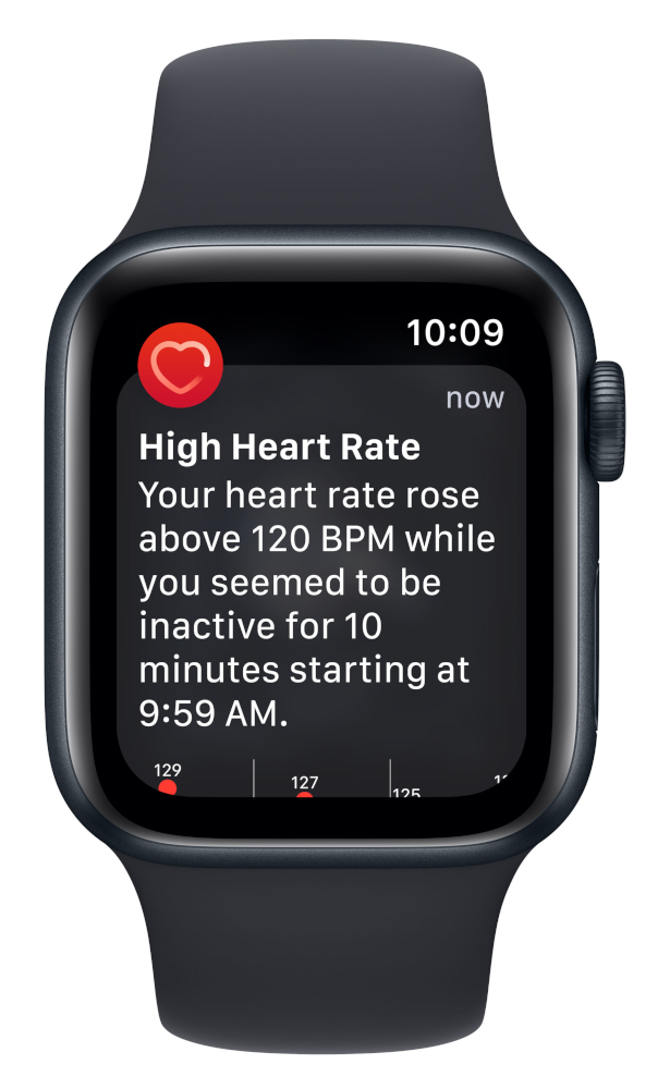 APPLE Watch SE (2nd generation) GPS + Cellular 40 mm Aluminium Midnight (MNPL3NF/A)