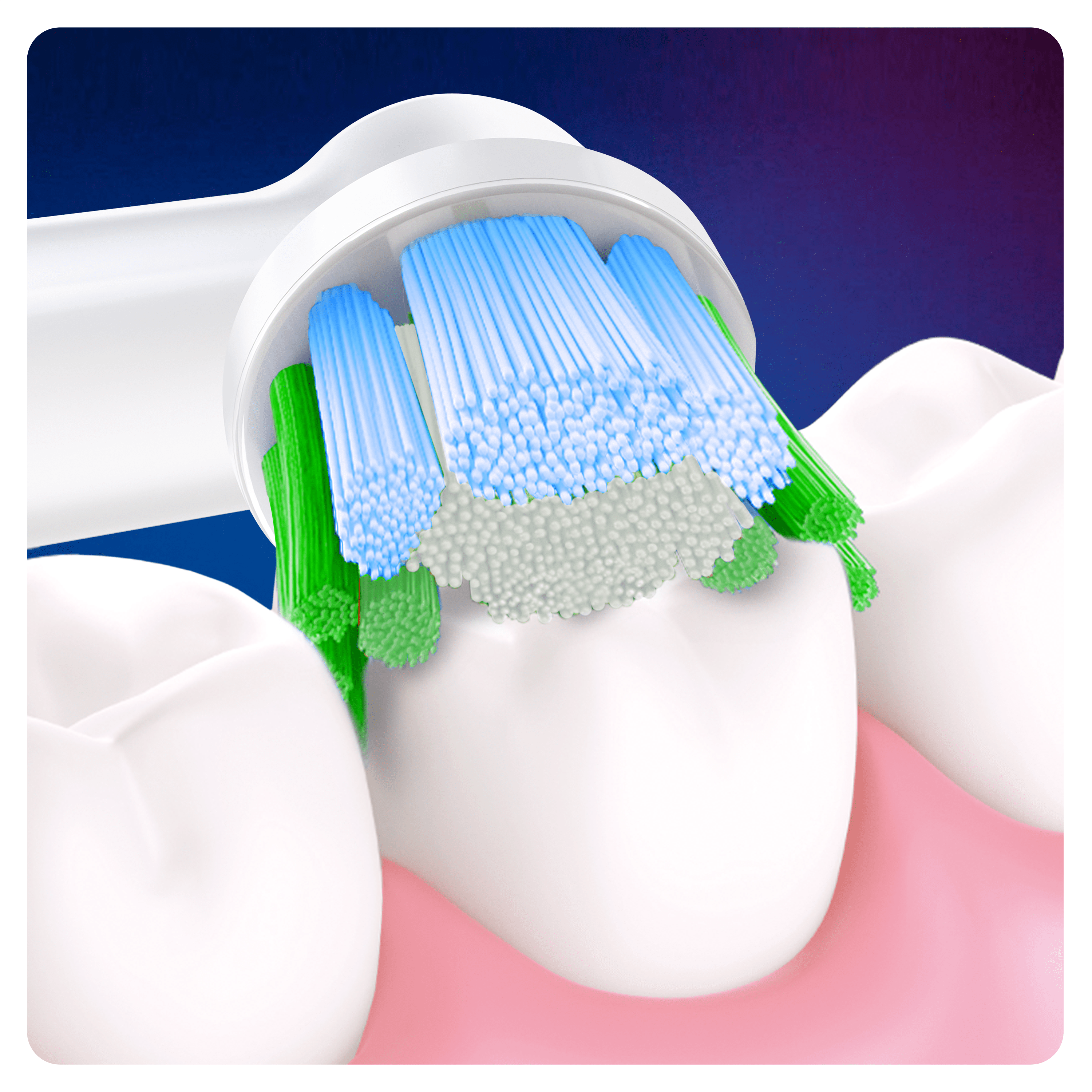 Electric toothbrush head with blue and green bristles, close-up of teeth and gums.