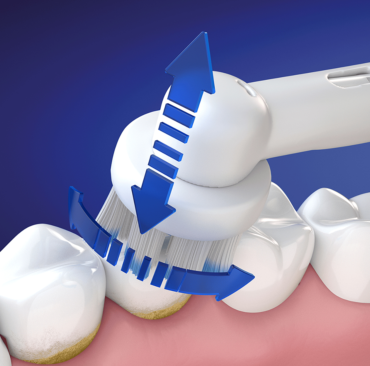 Primo piano di uno spazzolino che pulisce i denti con frecce blu che indicano il movimento.
