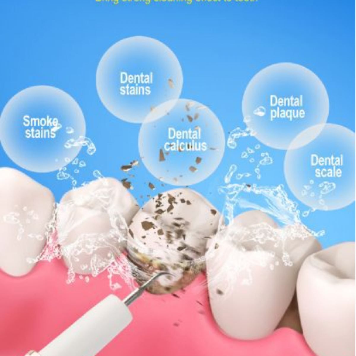 Zbliżenie zębów z czyszczeniem ultradźwiękowym i pęcherzykami powietrza.