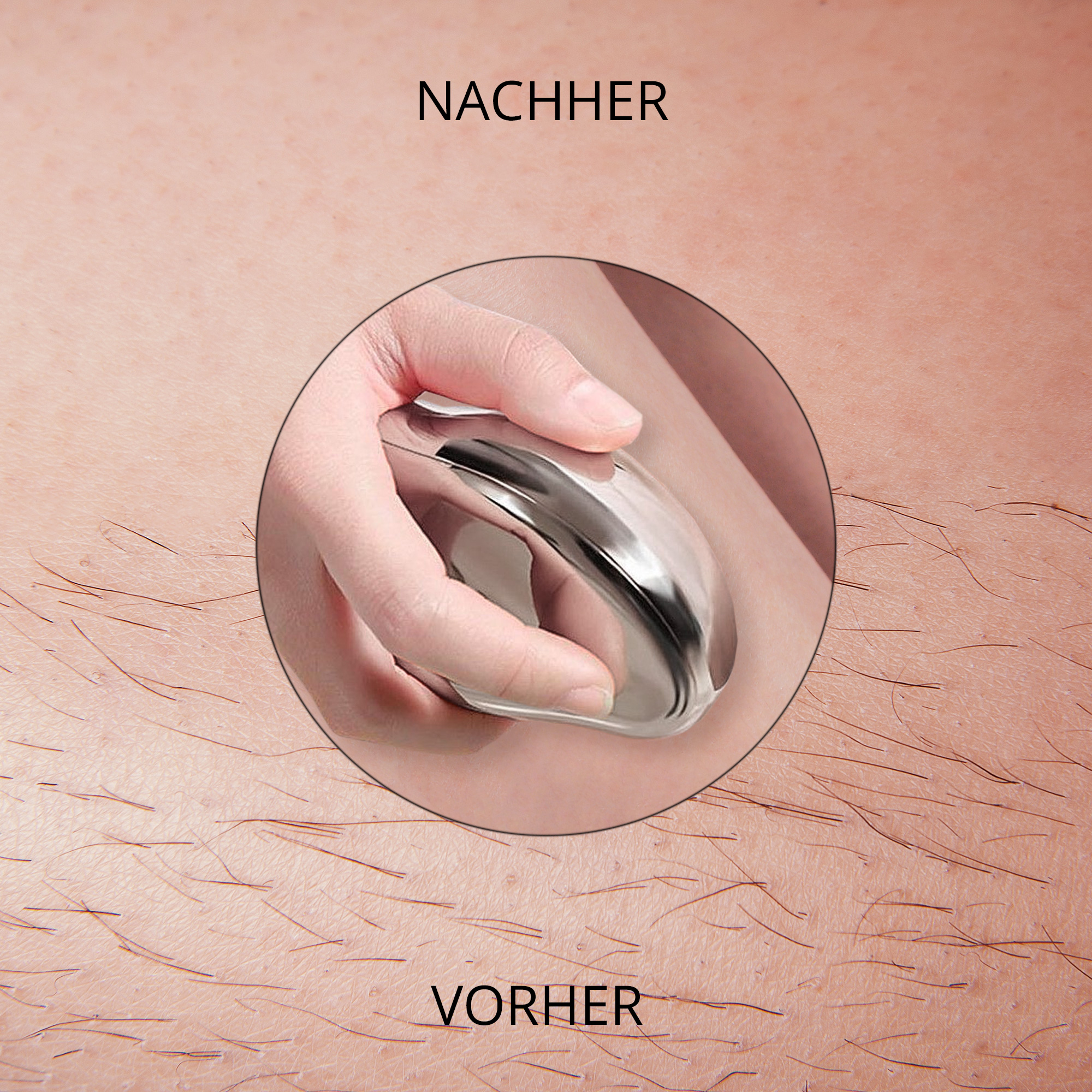 Haut mit Haaren vor und nach der Behandlung mit einem Metallwerkzeug.