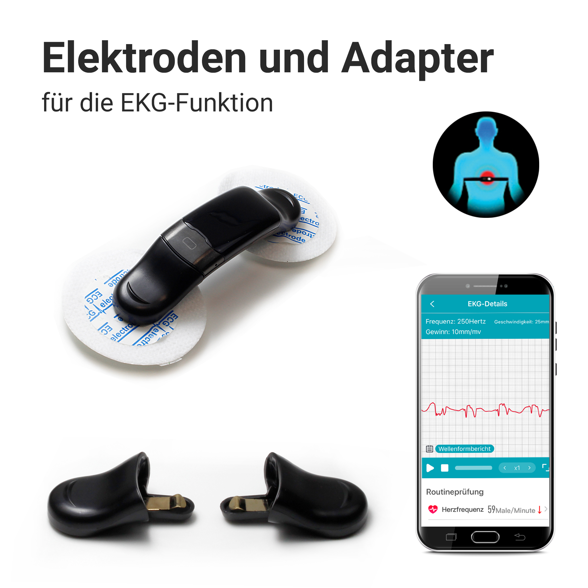 EKG-Elektroden, Adapter und Smartphone mit EKG-Anzeige.