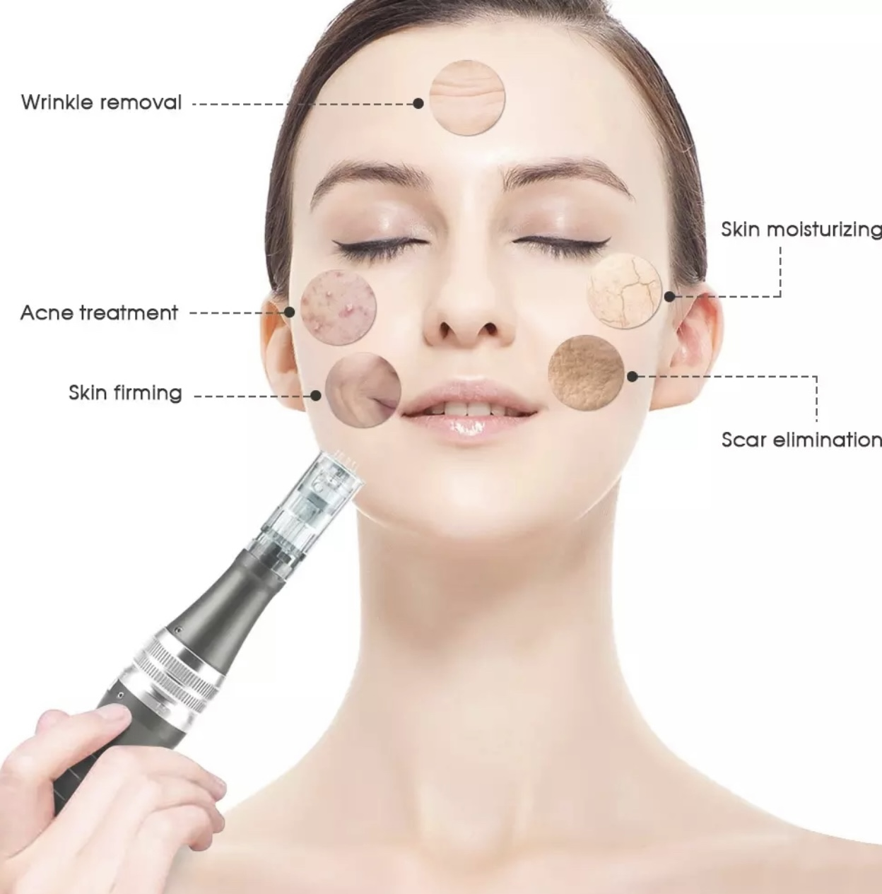 Twarz kobiety z zaznaczonymi obszarami leczenia: usuwanie zmarszczek, trądzik, ujędrnianie skóry, nawilżanie, blizny.