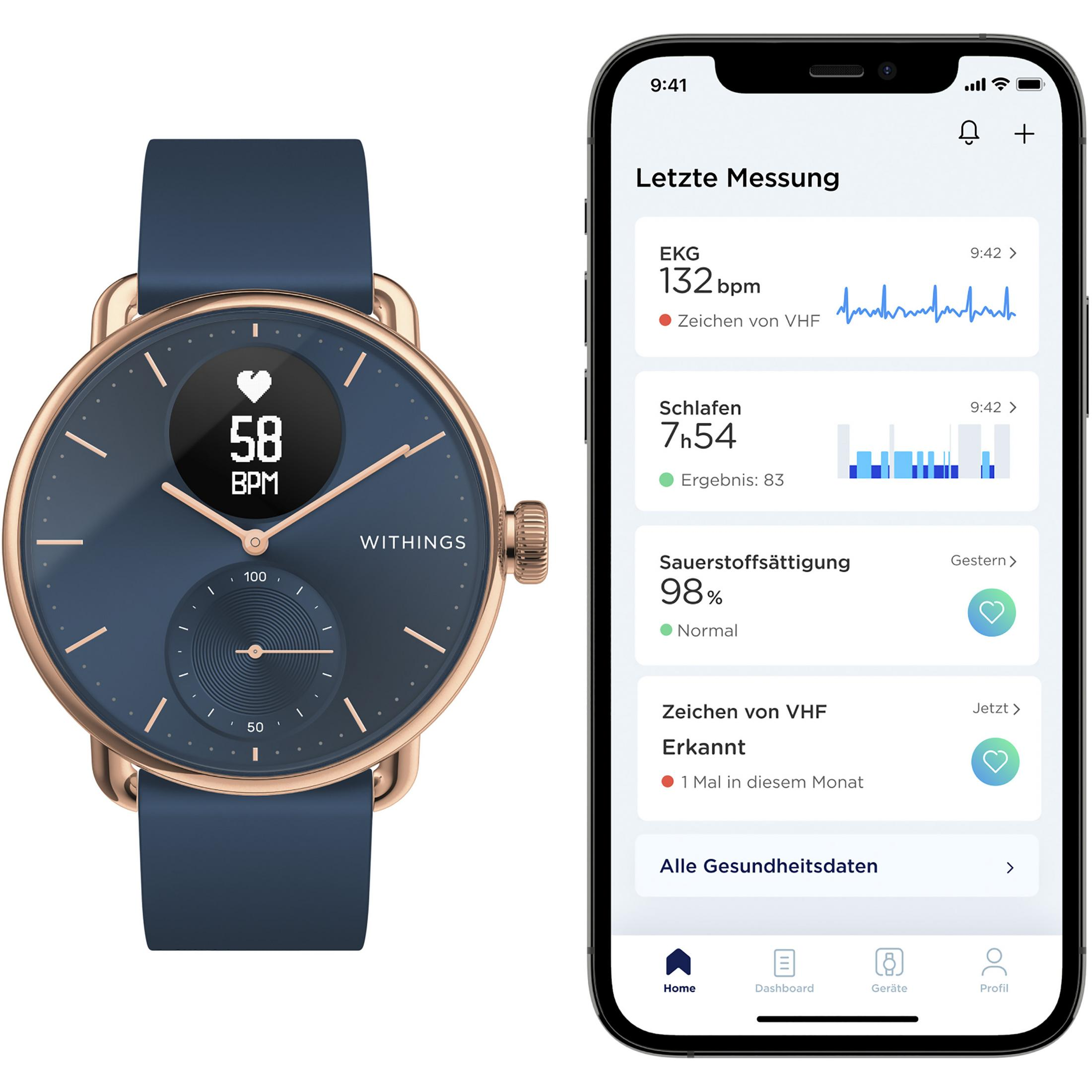 Smartwatch und Telefon mit Gesundheitsmetriken wie Herzfrequenz und Sauerstoffsättigung.