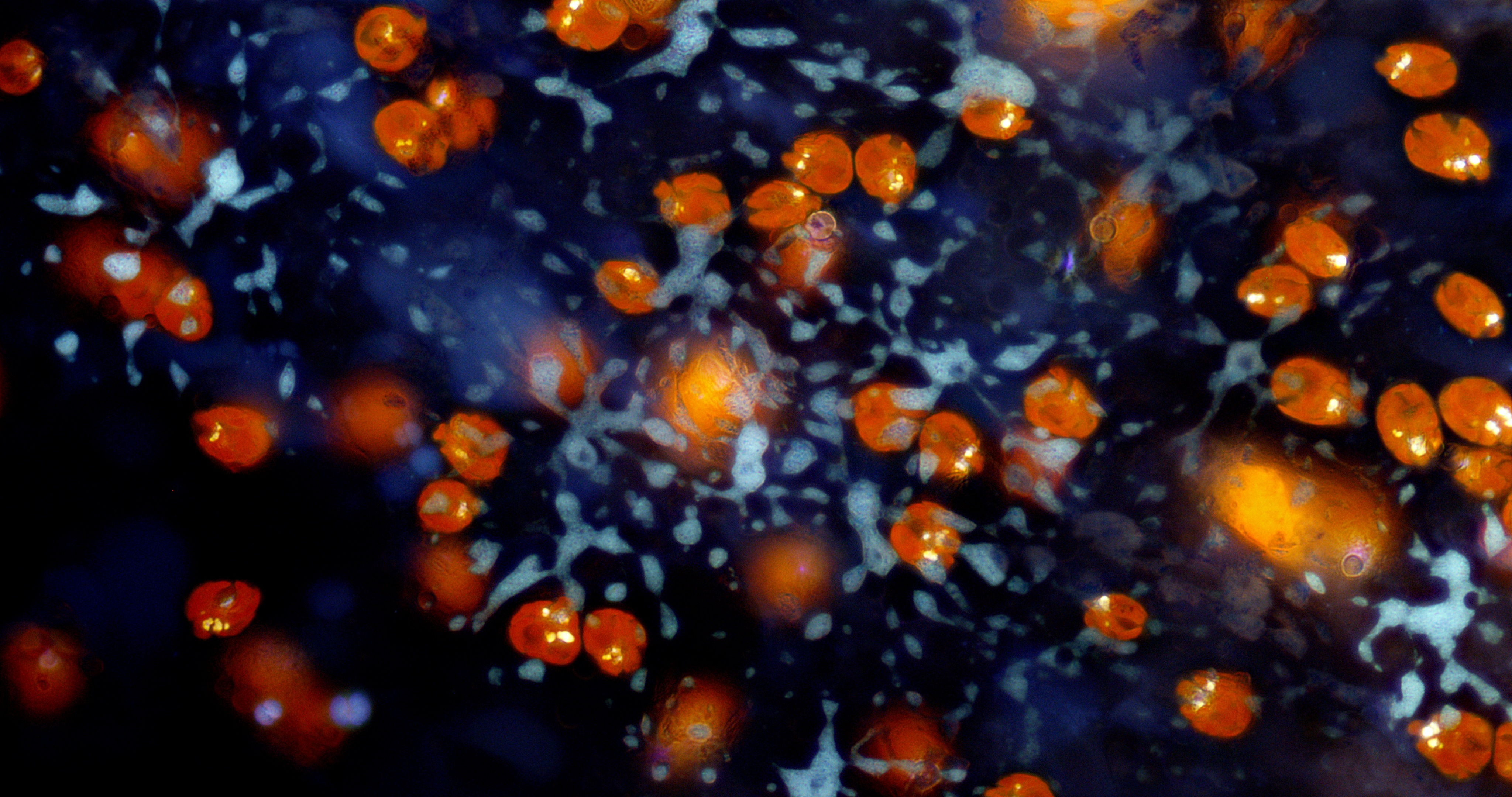 Imagen abstracta con formas naranjas y fondos azules. Tiene burbujas y puntos.