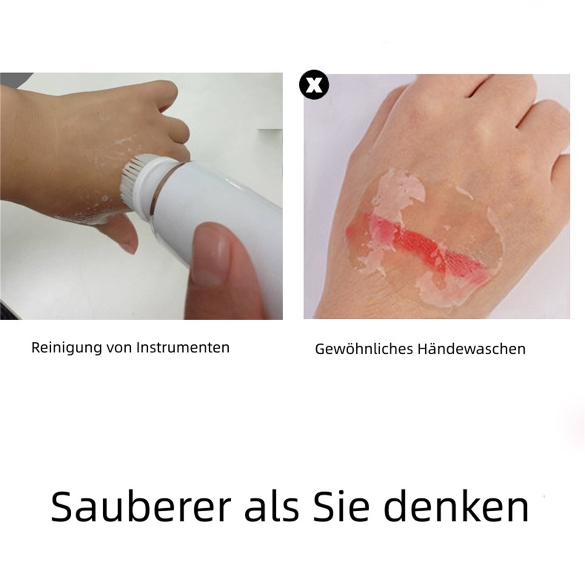 Hände, eine mit Bürste waschend, die andere mit roter, entzündeter Stelle. Text: Sauberer als Sie denken.