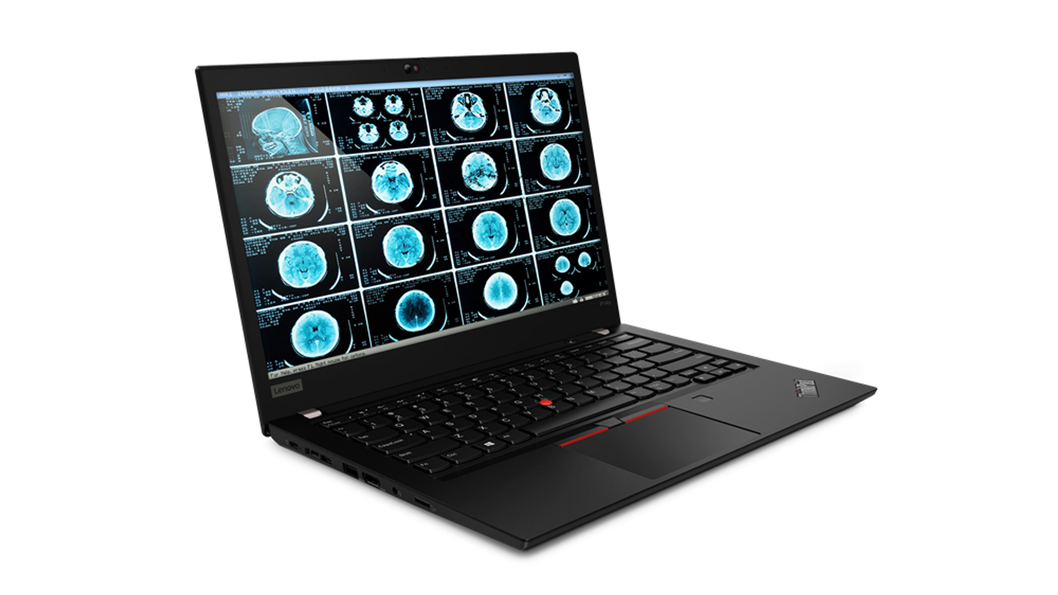 Black laptop displaying brain MRI scans on screen, angled view. White background.