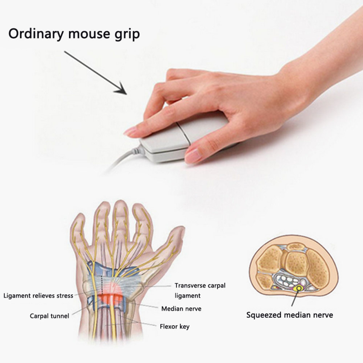 Eine Hand hält eine Maus. Darunter Diagramme von Hand und Handgelenk.