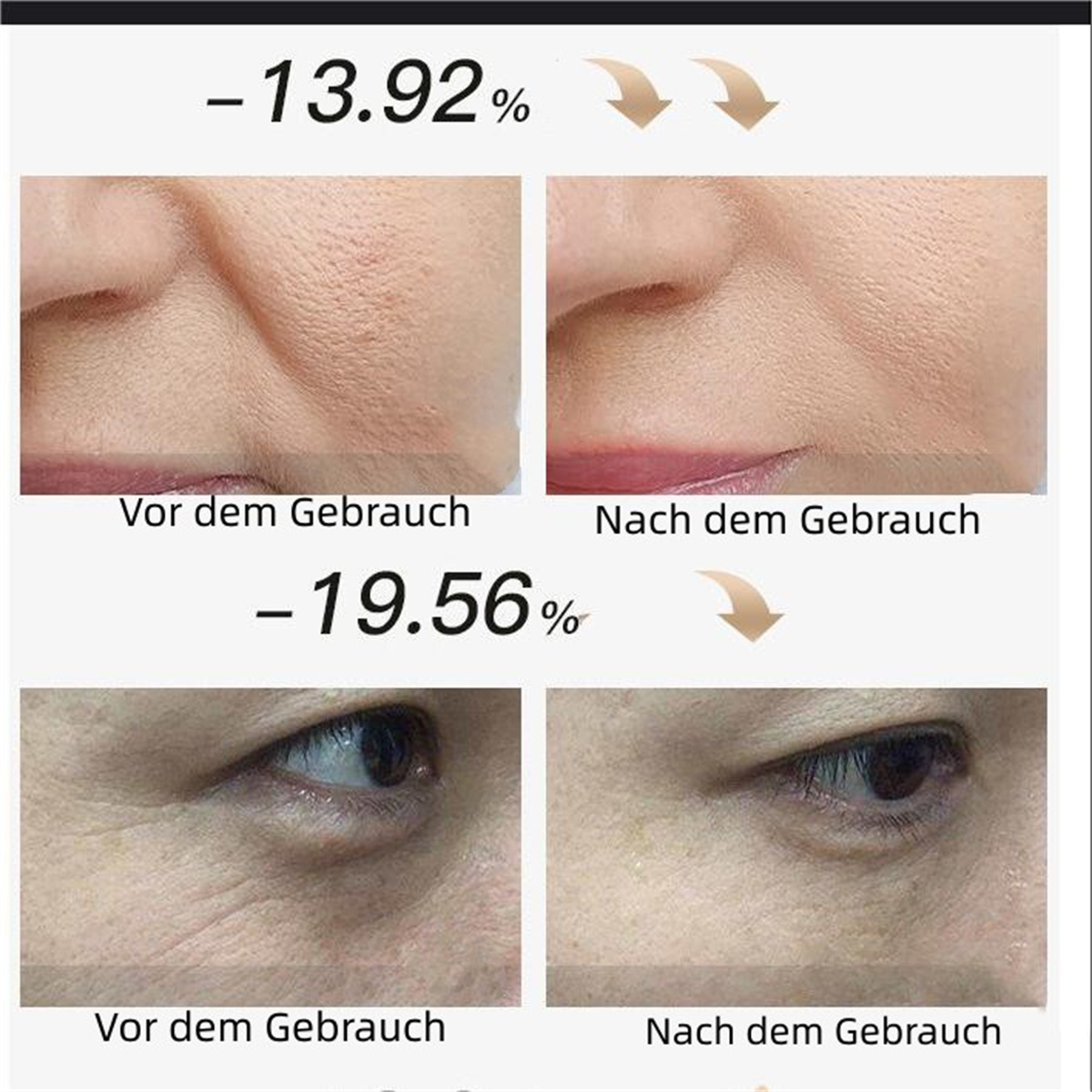 Imágenes que comparan la piel facial antes y después del uso, con cambios porcentuales mostrados.