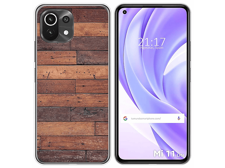 Vauki Cover Glitter con Cordino per Xiaomi 11 Lite 5G NE/Mi 11 Lite 4G/5G, Custodia Trasparente
