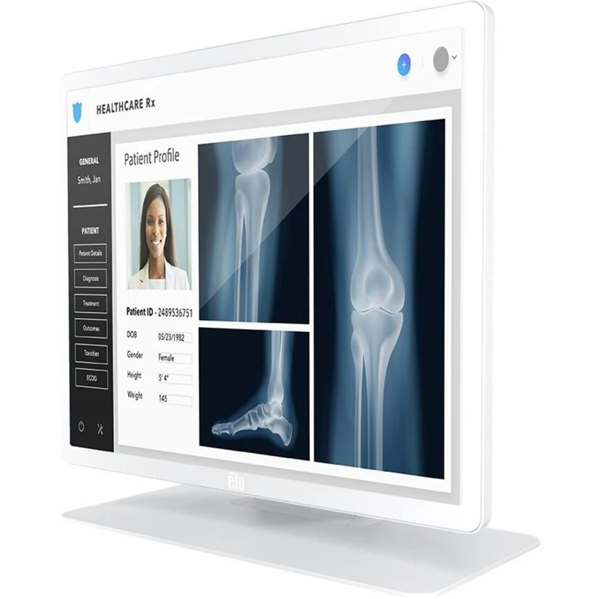 Una pantalla de computadora que muestra un perfil de paciente con imágenes de rayos X. La pantalla tiene un marco blanco.
