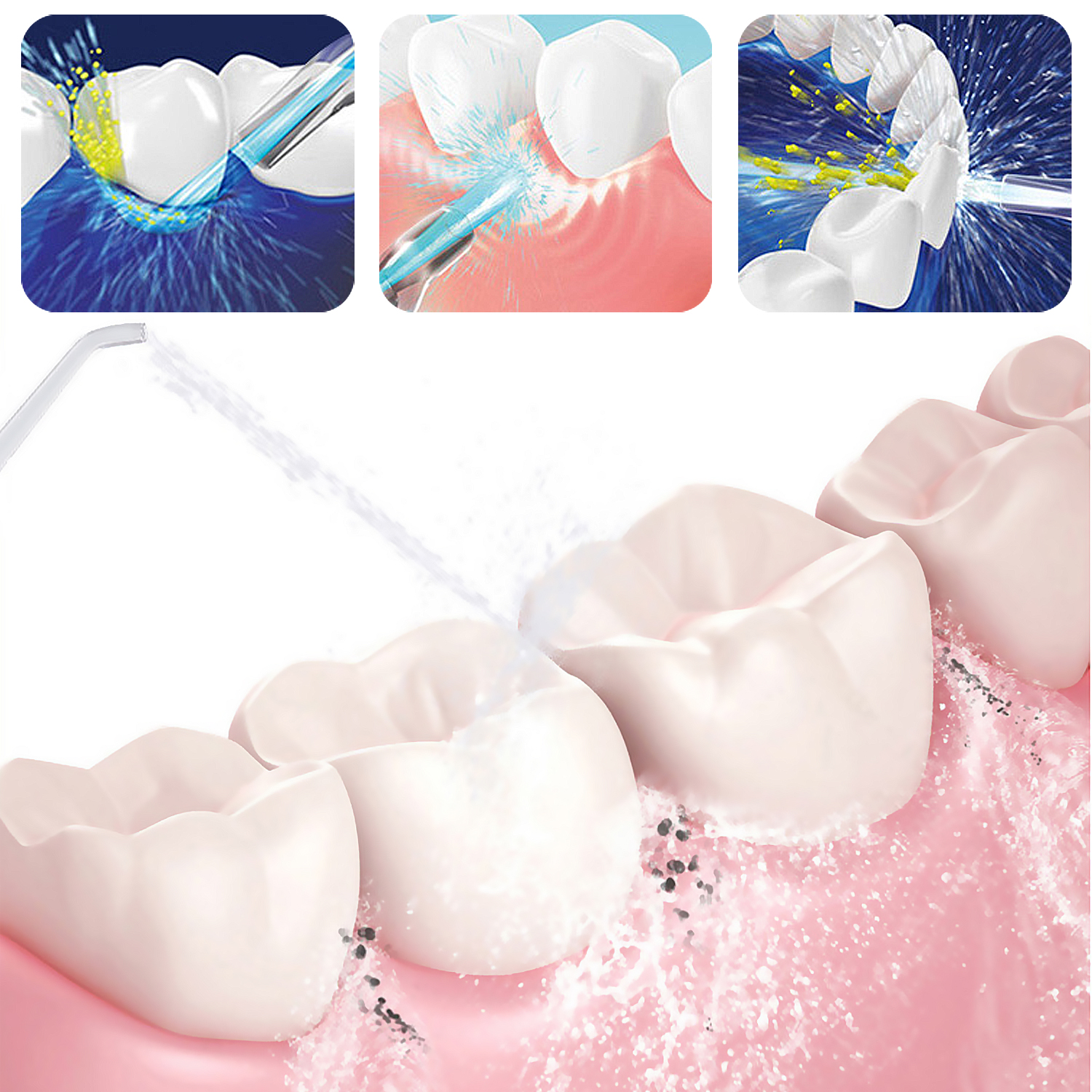 Diagrama de limpieza dental, con chorro de agua limpiando dientes y encías, sobre fondo blanco.