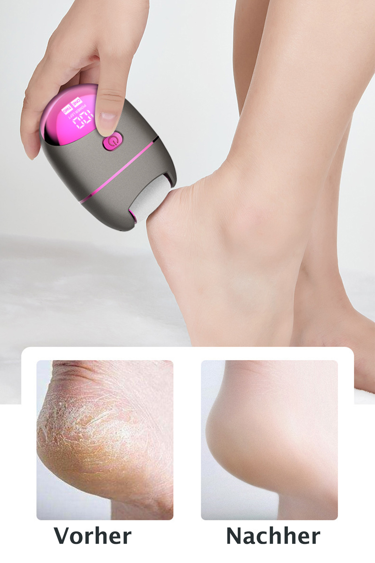BRIGHTAKE Elektrischer Fußschleifer zu Weiß Hause Perfekte Pediküre Fußpflege 