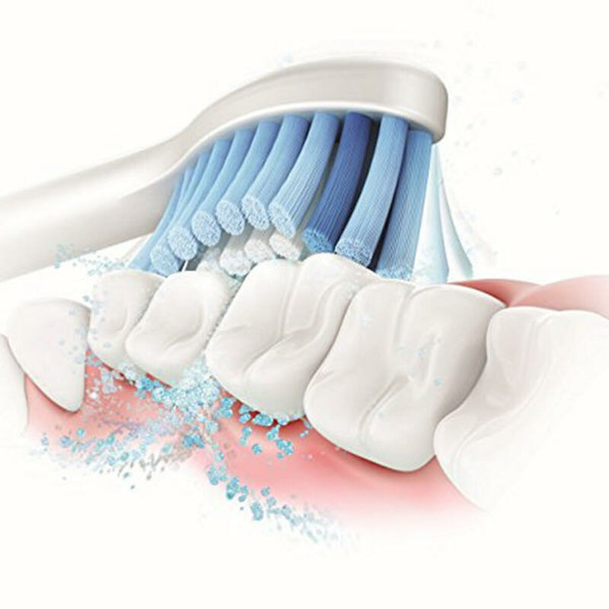 Denti che vengono puliti da uno spazzolino da denti. Sono visibili setole blu e acqua. Le gengive sono rosse.