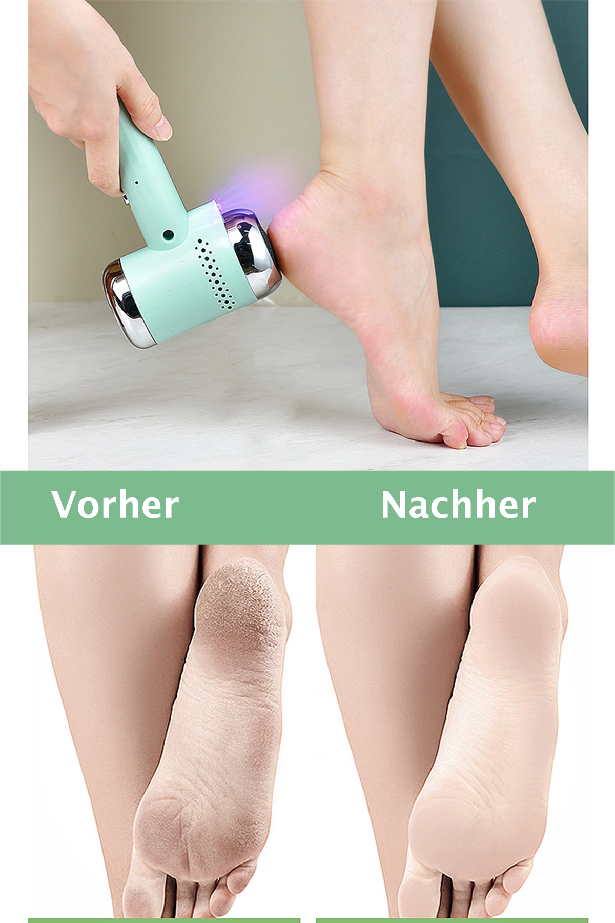 BRIGHTAKE Automatischer elektrischer Fußschleifer Ihre Sie - Grün Glätten Aufwand Pediküre Füße ohne