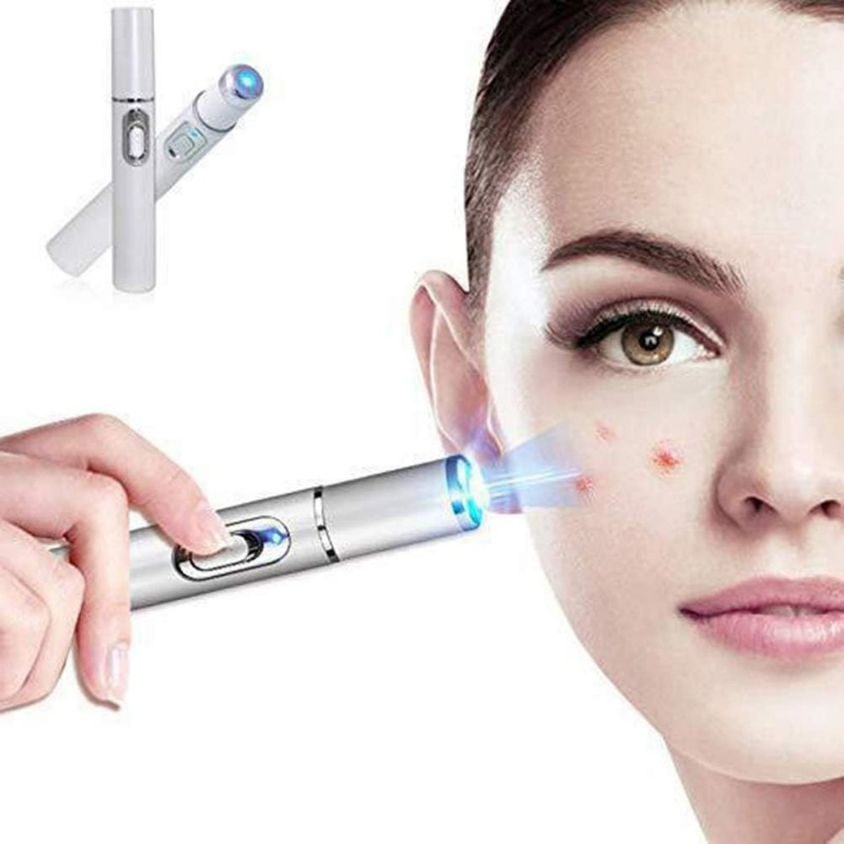Das Gesicht einer Frau mit einem Laser-Akne-Behandlungsgerät, das auf einen Pickel gerichtet ist. Ein weiteres Gerät befindet sich links.