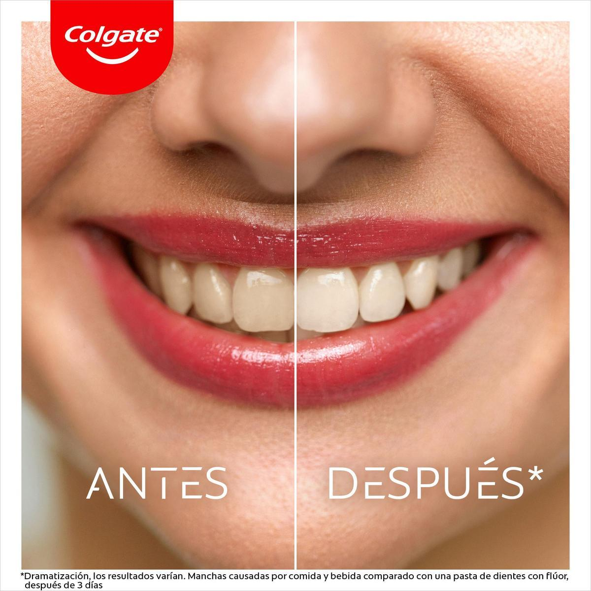Imagen que compara los dientes antes y después del uso de pasta de dientes. Los dientes 'antes' están manchados; los dientes 'después' son más blancos.