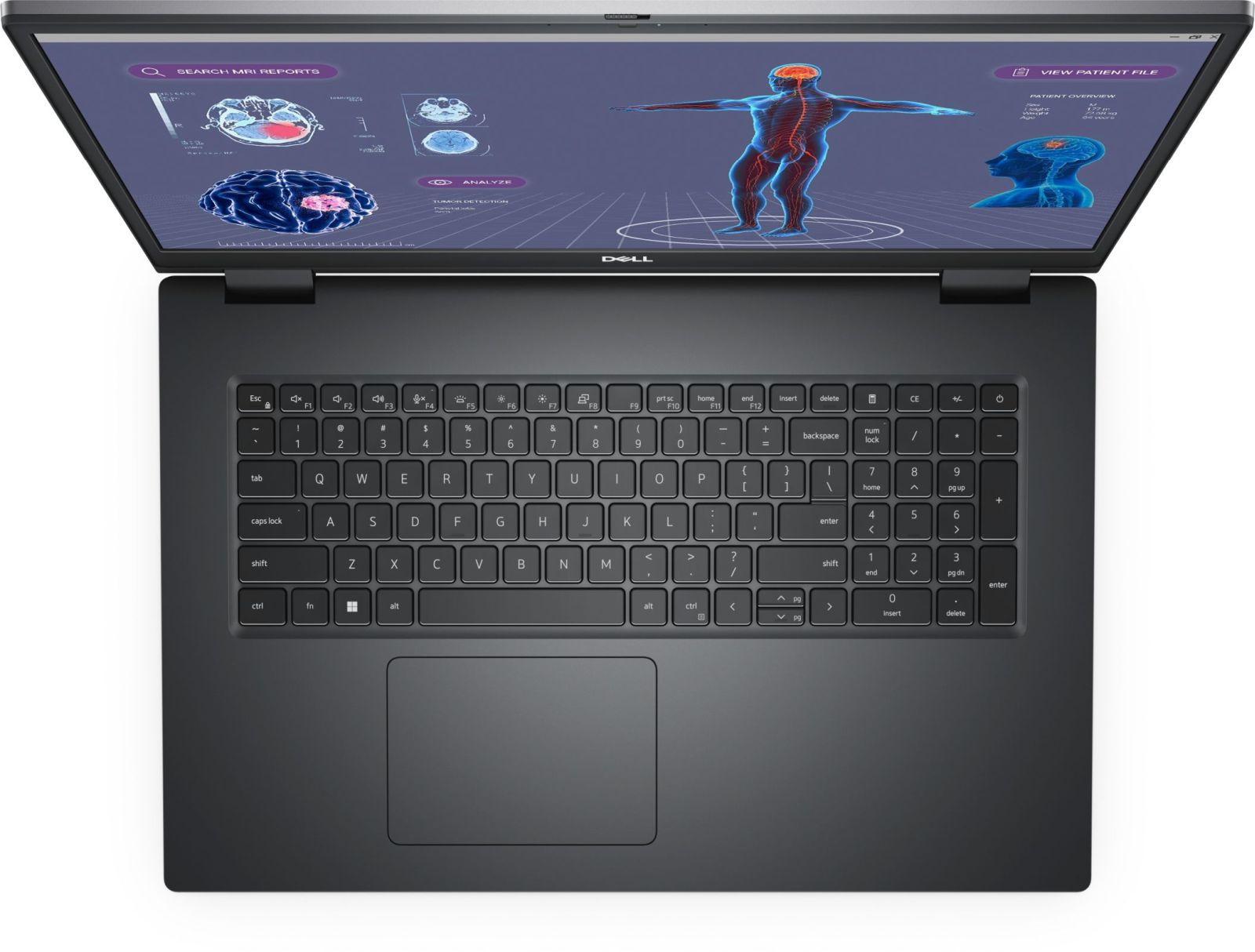 7780 Intel Intel® Zoll 1 17,3 RAM, cm Grau GB i7-13850HX Core™ TB mit Notebook 43.2 32 (17\