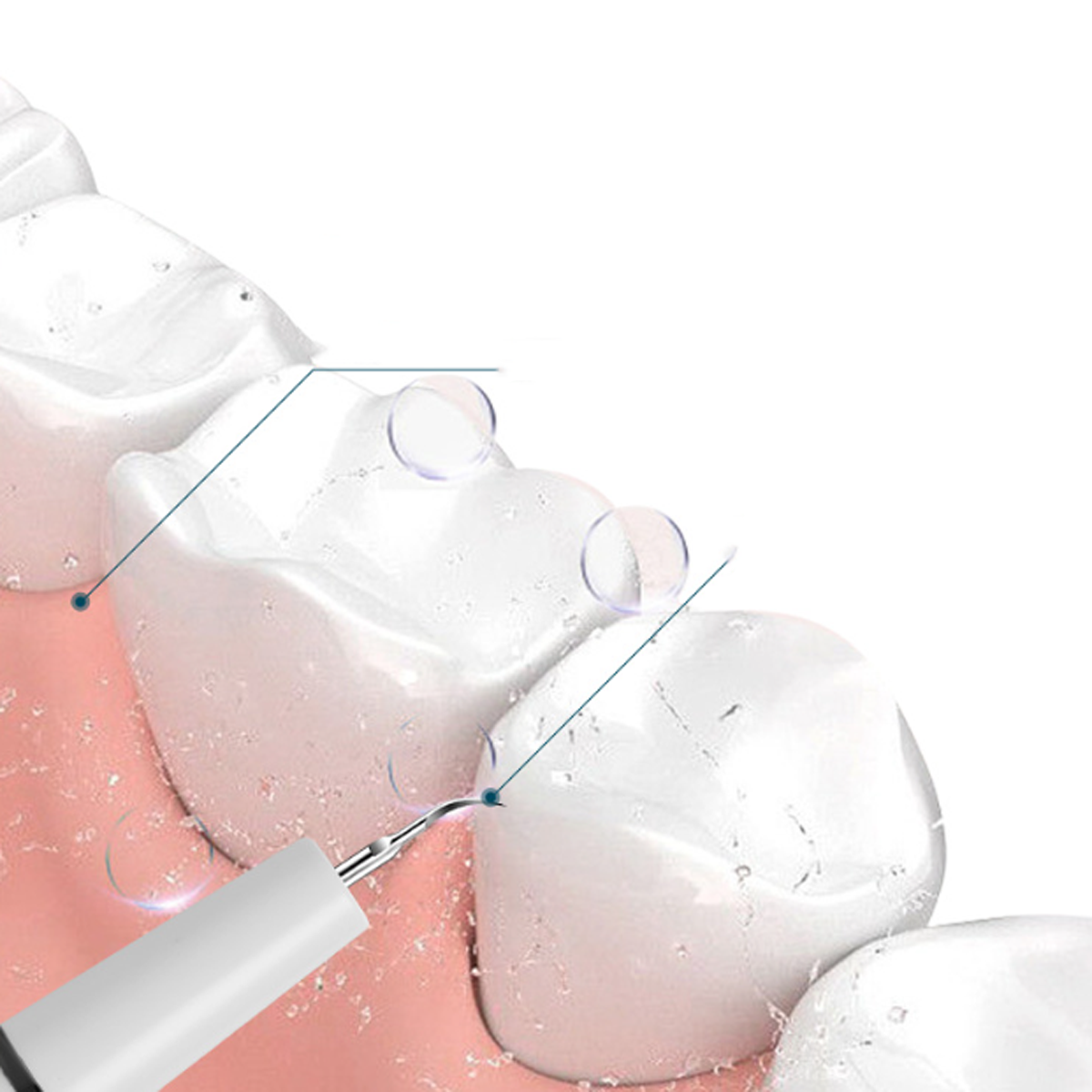 LACAMAX Elektrischer Ultraschall-Zahnreiniger, Hände Füßen den Munddusche weh, IPX7 Wasserdicht tun nicht Saubere