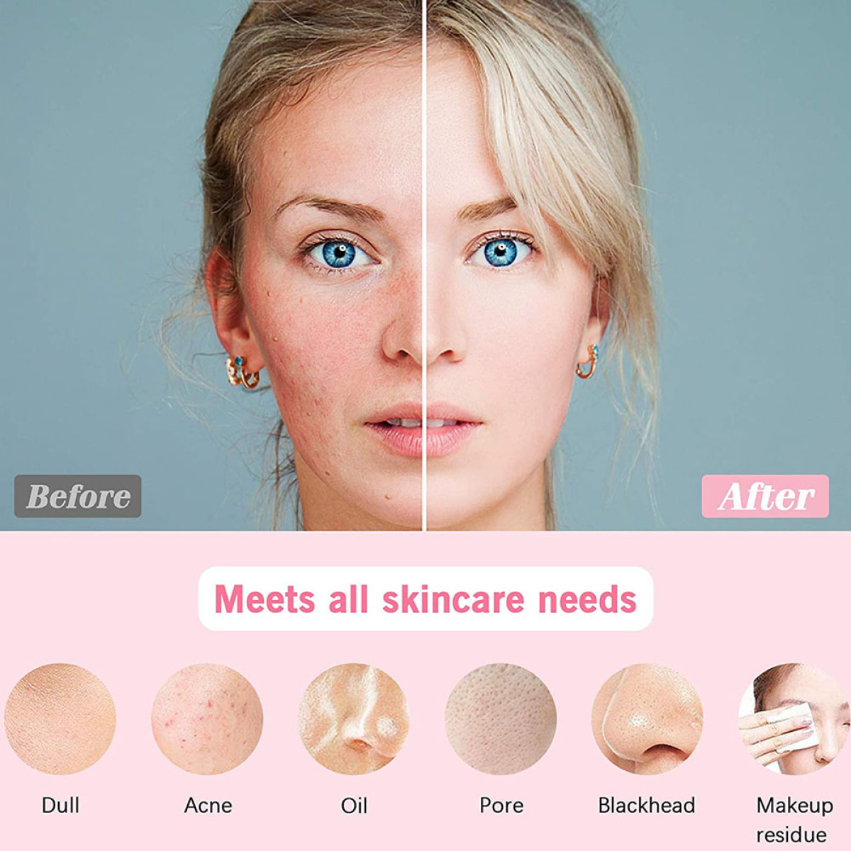 ELKUAIE Mit 3D-Schallvibrationen und Farbtherapie Rosa Gesichtsbürste