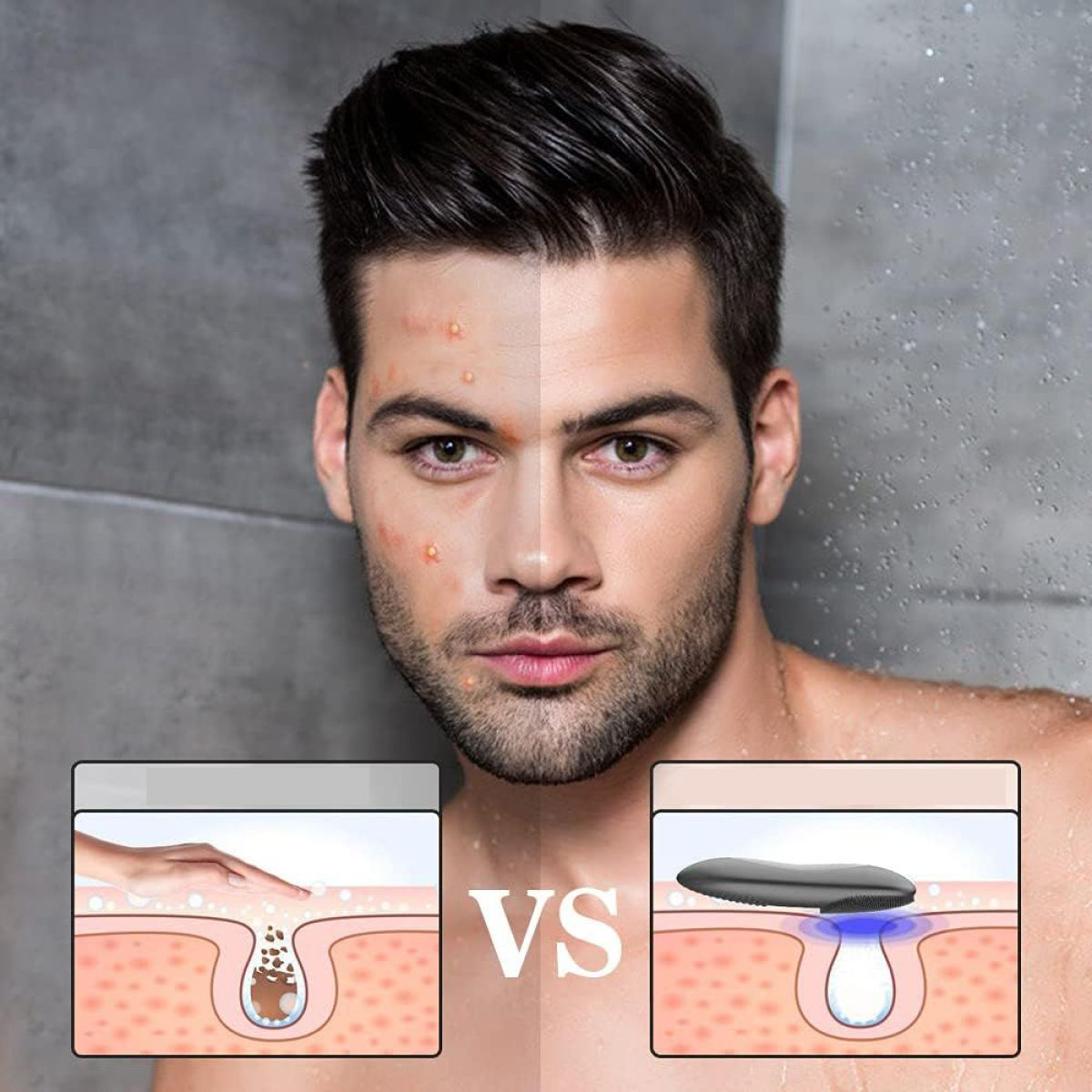 Gesicht eines Mannes mit Hautproblemen vs. gesunder Haut. Zwei Illustrationen zeigen den Zustand.