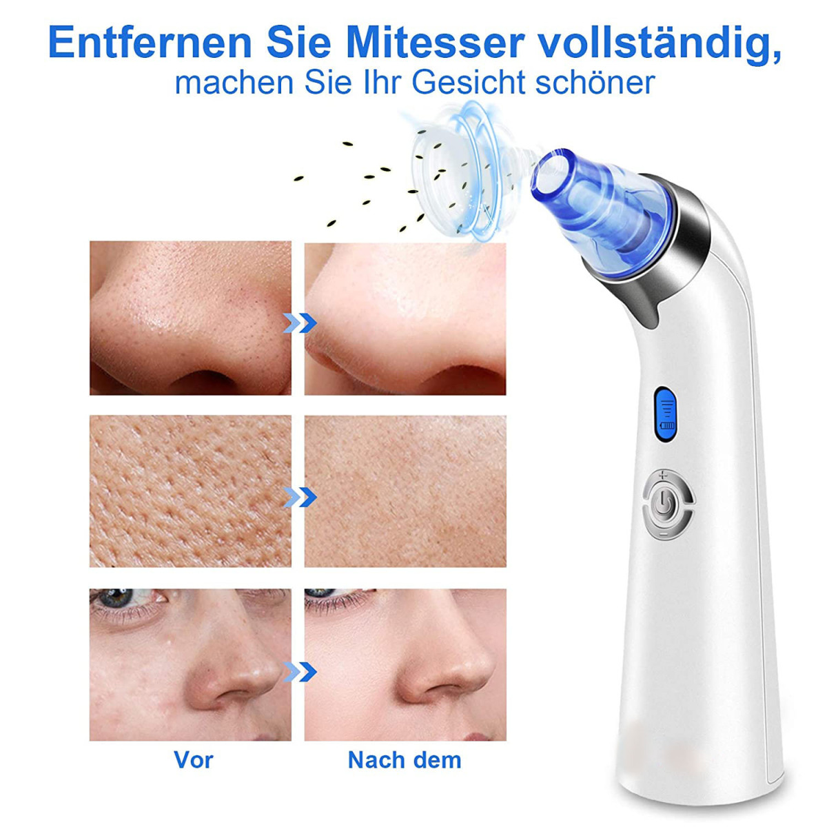 Gerät zum Entfernen von Mitessern von der Haut. Vorher- und Nachher-Aufnahmen der Haut werden gezeigt.