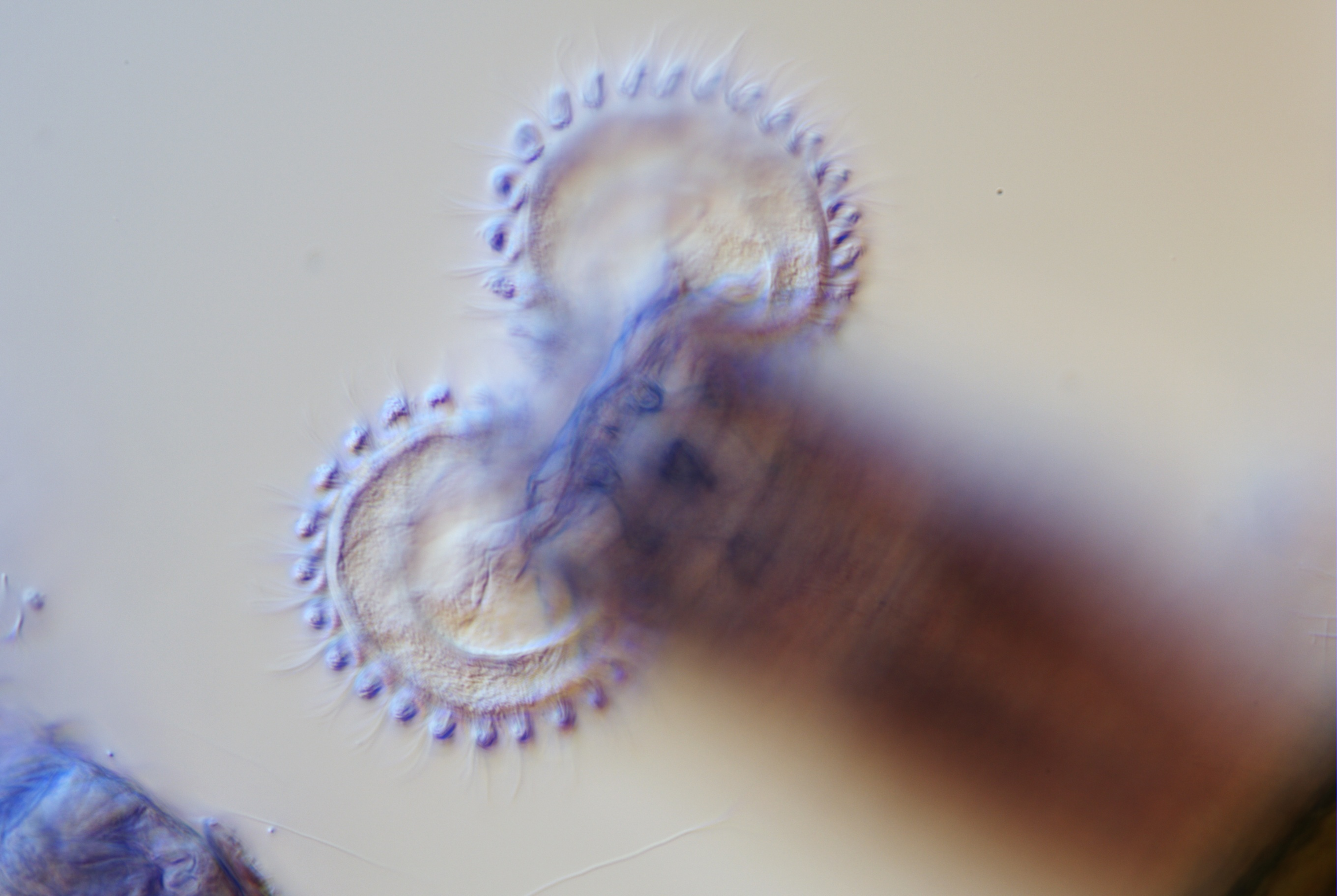 Vista microscópica de granos de polen con patrones circulares y bordes puntiagudos, en un fondo claro.
