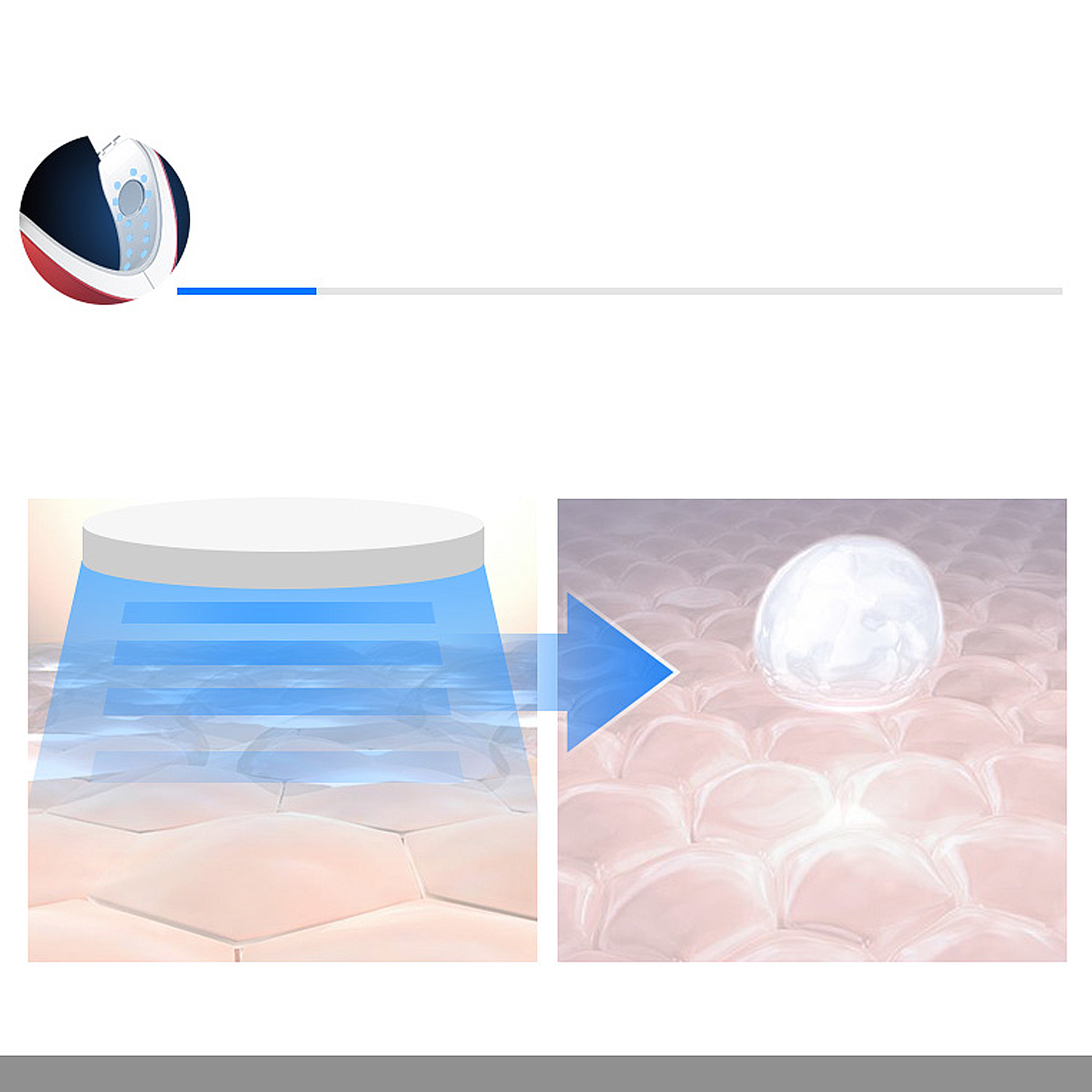 Diagramma che mostra la tecnologia per la cura della pelle. Un dispositivo emette luce blu, strati di pelle ricevono trattamento.