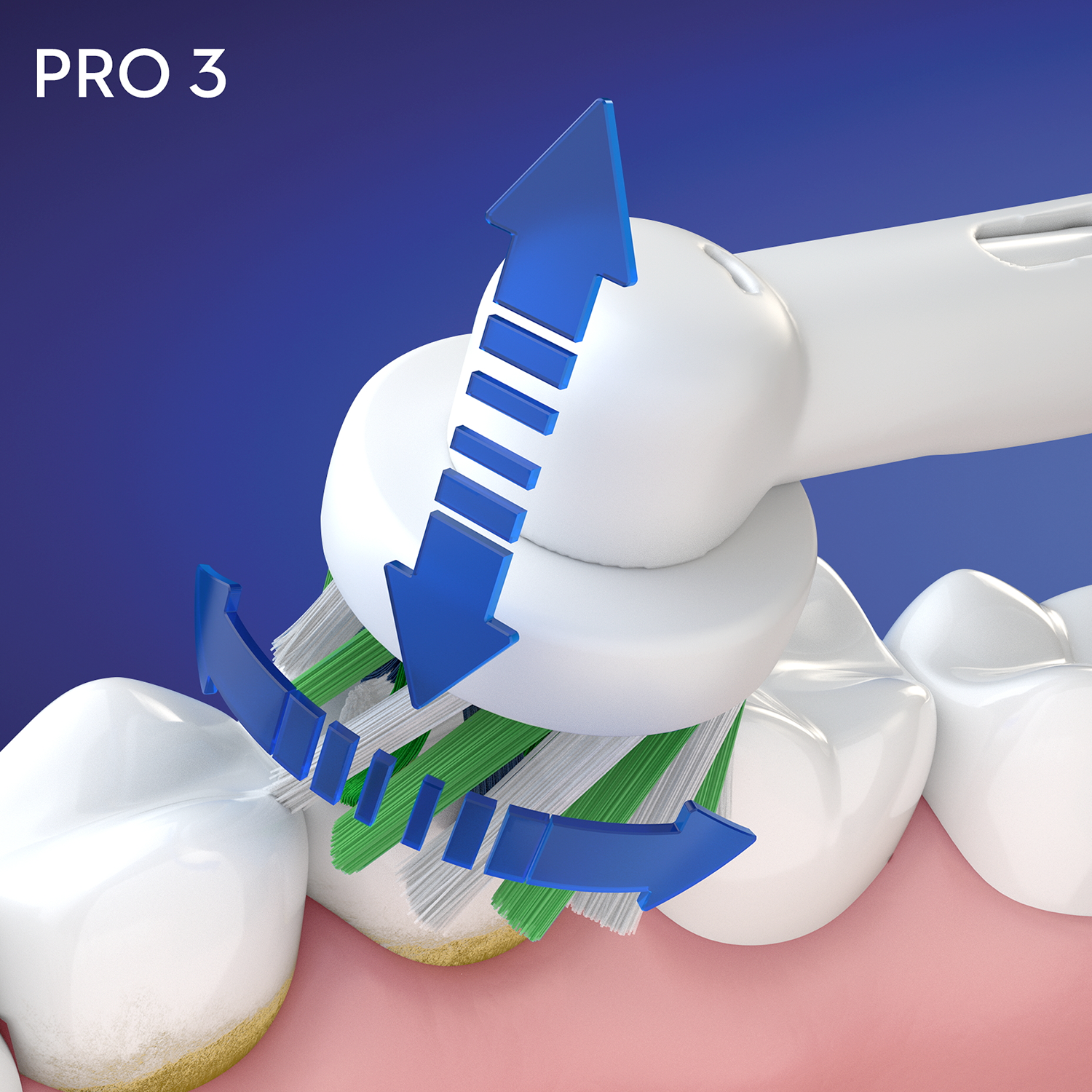 Primer plano del cabezal de un cepillo de dientes eléctrico limpiando dientes con flechas azules que indican la acción de limpieza.