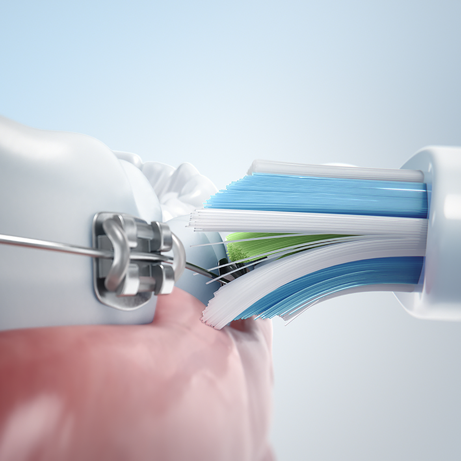 Spazzolino elettrico che pulisce i denti con apparecchio visibile, setole visibili.