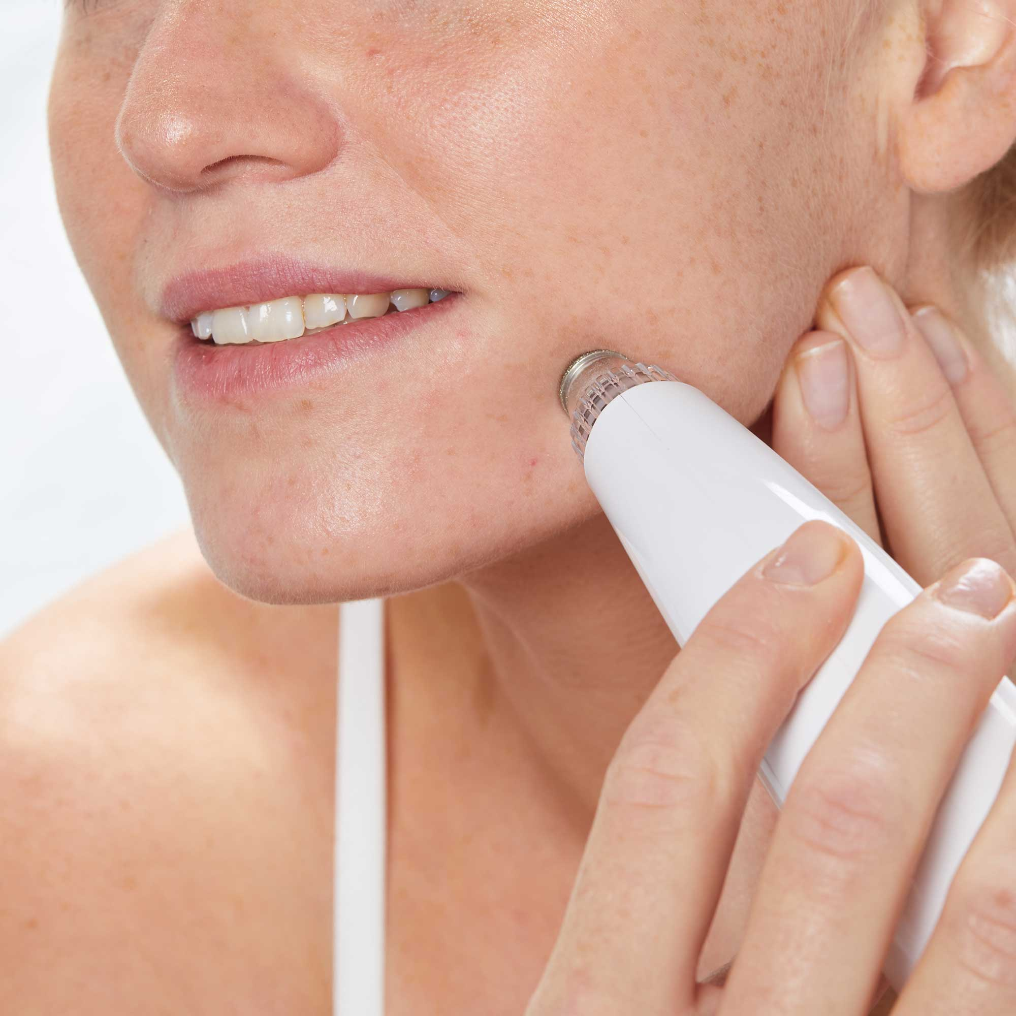 Woman using a white pore vacuum on her cheek, close-up view.
