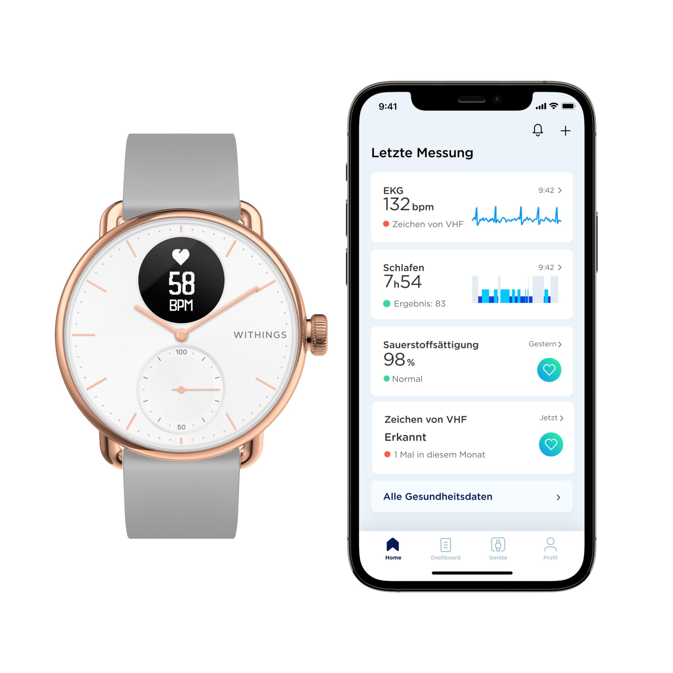 Eine Uhr in Roségold mit weißem Zifferblatt zeigt 58 BPM. Ein Handy zeigt Gesundheitsdaten.